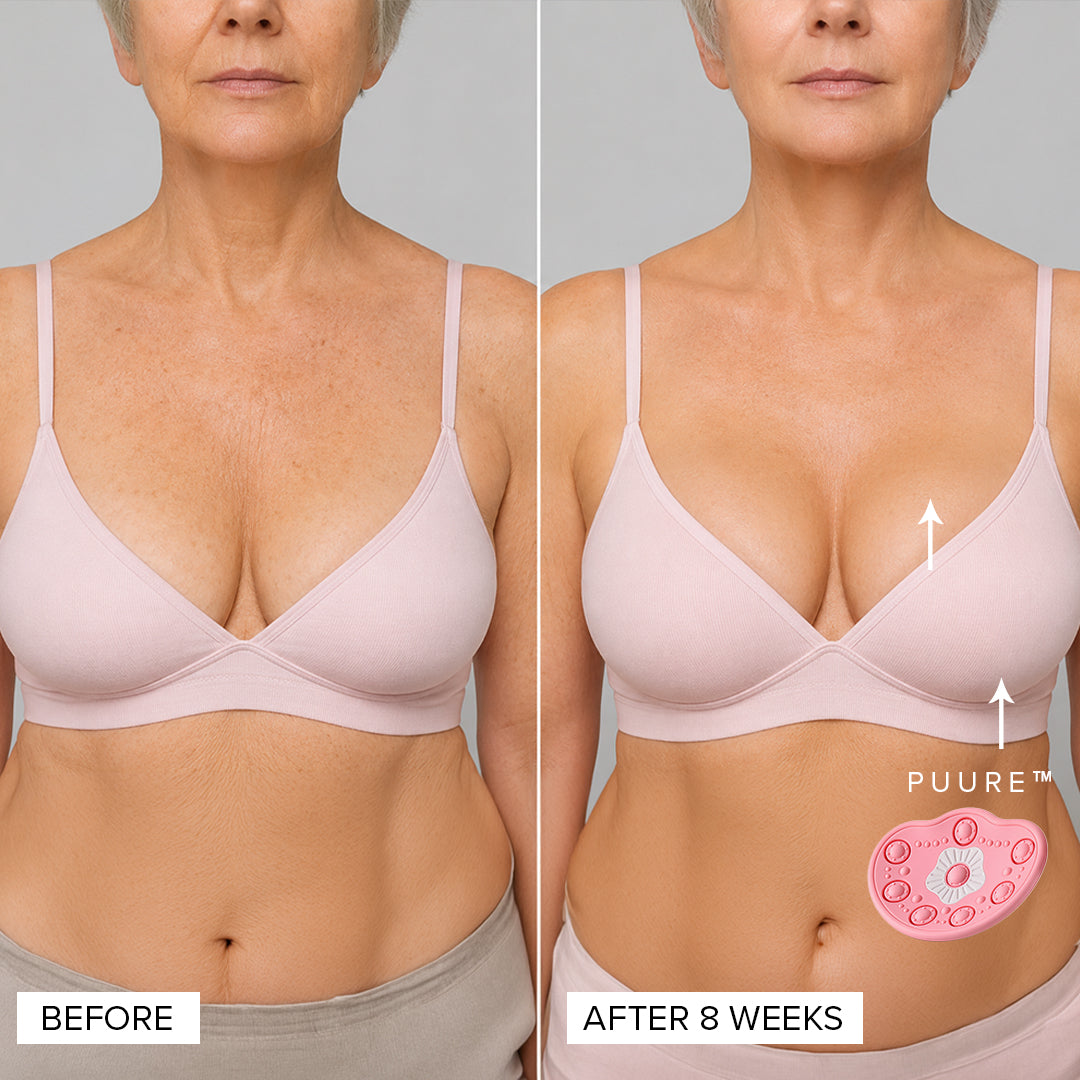 Puure™ Breast Lift Device